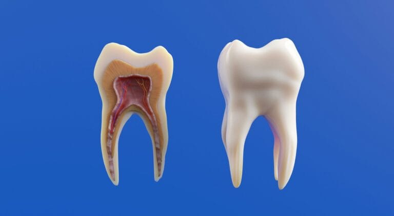 How Long Does Wisdom Teeth Recovery Take Everything You Need to Know